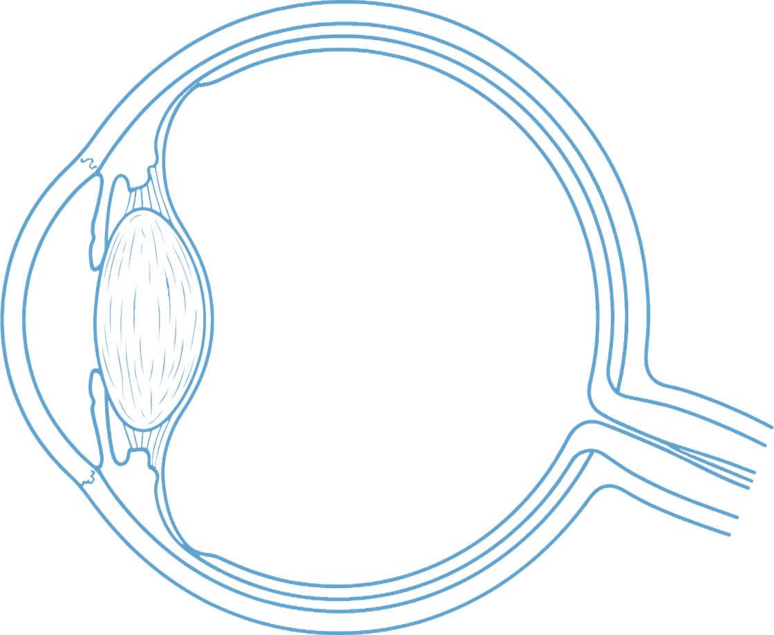 Cross-section diagram of the eye, with the cornea and lens at the front and the optic nerve at the back